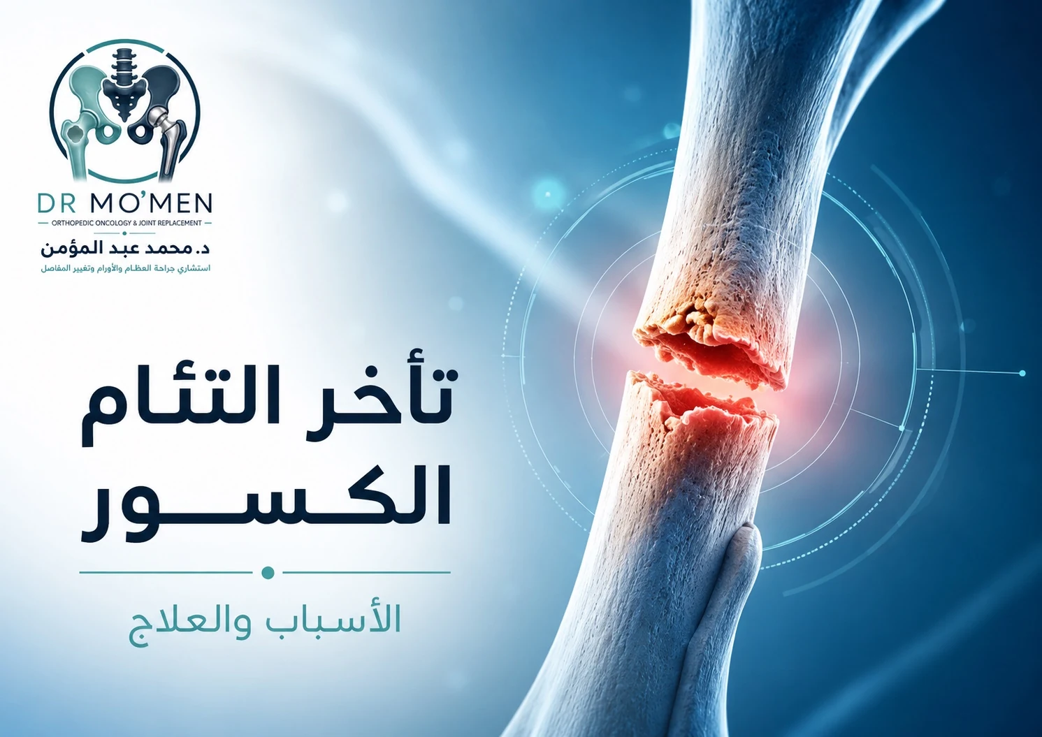 تأخر التئام الكسور وعدم الالتئام وأسباب عدم جبر العظم وطرق العلاج