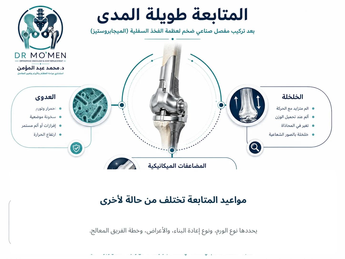 المتابعة طويلة المدى للمفصل الصناعي الضخم للكشف عن العدوى والخلخلة والمضاعفات الميكانيكية