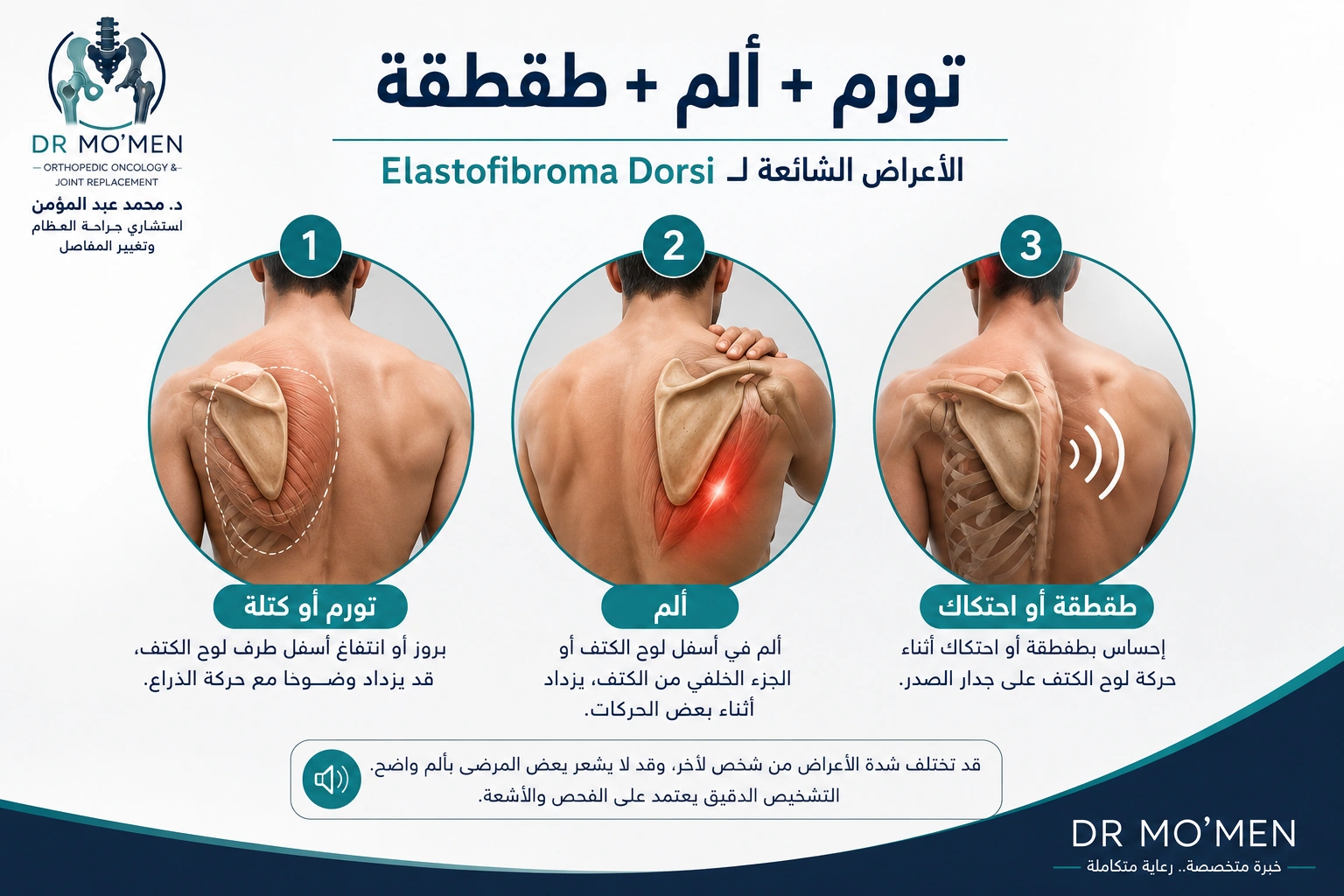 إنفوجرافيك يوضح تورم وألم وطقطقة لوح الكتف في Elastofibroma Dorsi