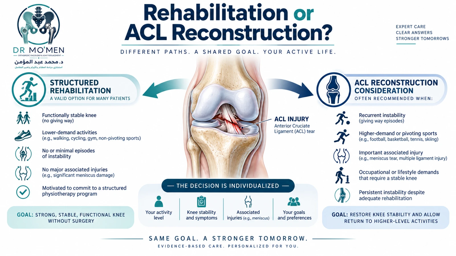 Rehabilitation or ACL Reconstruction? Medical illustration explaining factors used to decide between structured rehabilitation and ACL reconstruction.