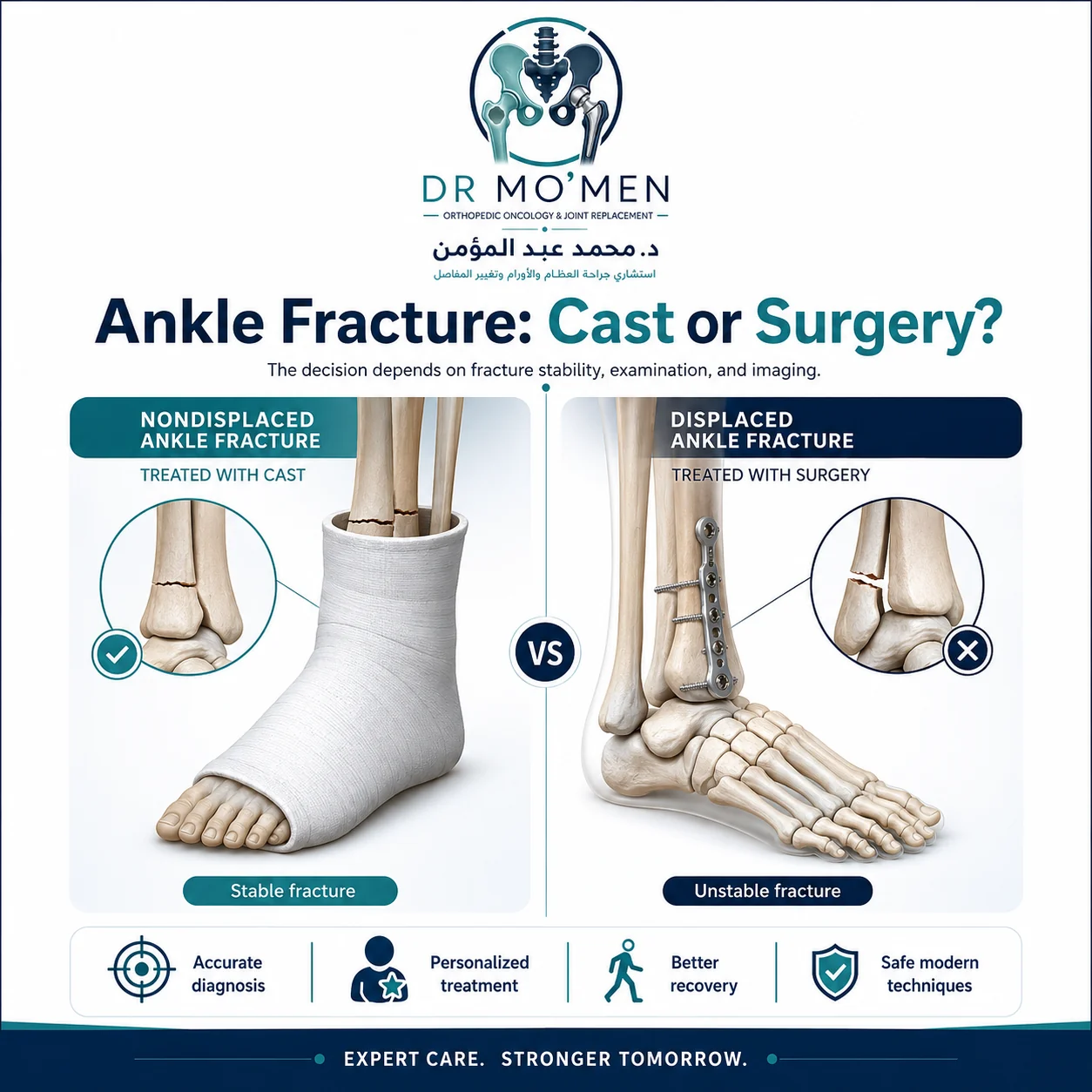 Medical infographic comparing cast treatment and surgery for ankle fractures