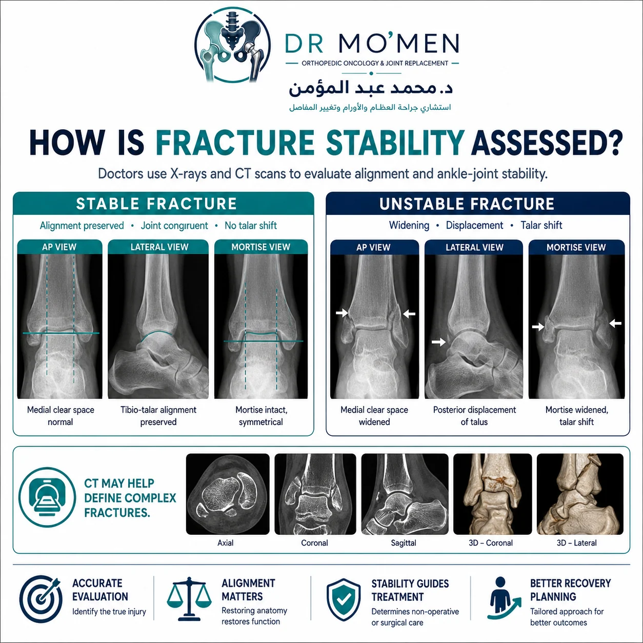 Imaging-based comparison of stable and unstable ankle fractures