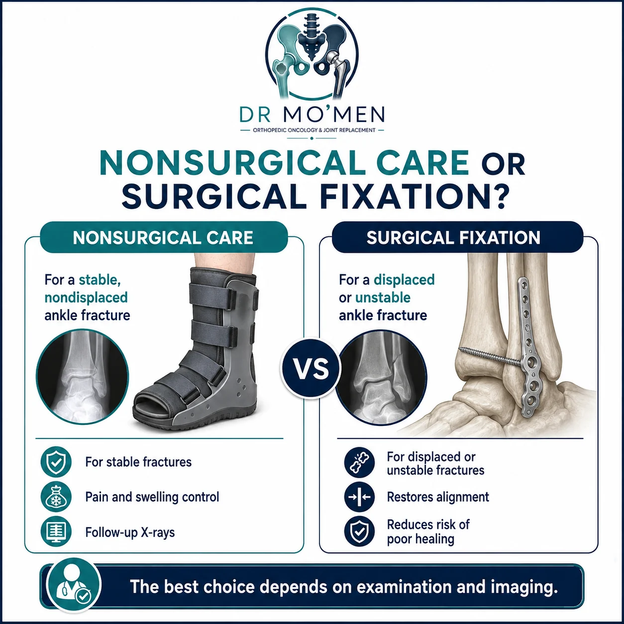Medical infographic comparing nonsurgical care and surgical fixation for ankle fractures