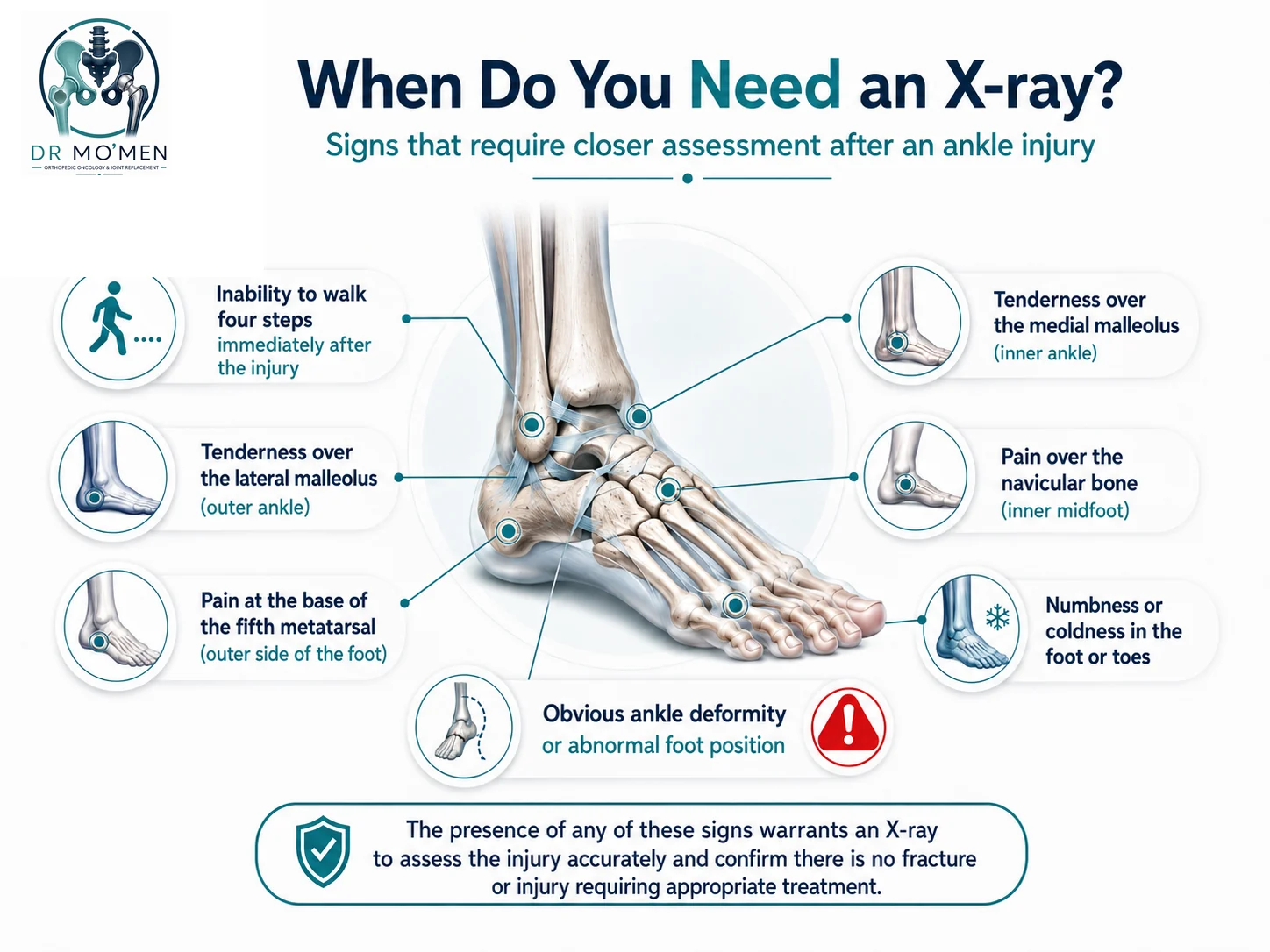 Ankle and foot warning signs that may indicate the need for an X-ray after an injury.