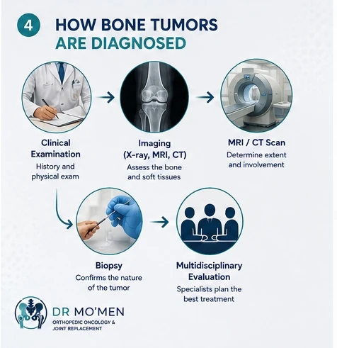 Diagnosis pathway for bone tumors including clinical examination, imaging, MRI or CT, biopsy, and multidisciplinary evaluation.
