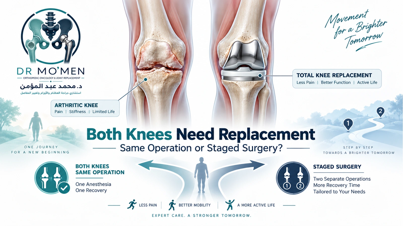 Both Knees Need Replacement 3D medical illustration showing bilateral knee arthritis and the decision between simultaneous and staged bilateral knee replacement.