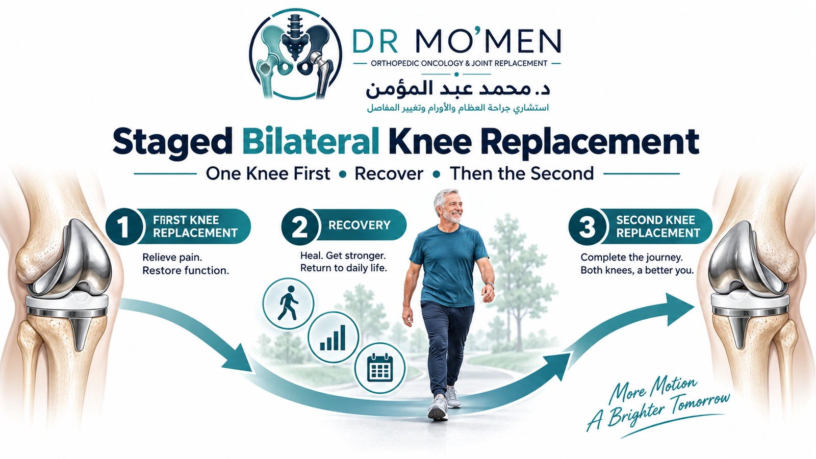 Staged Bilateral Knee Replacement Medical infographic explaining staged bilateral knee replacement with separate operations and recovery.