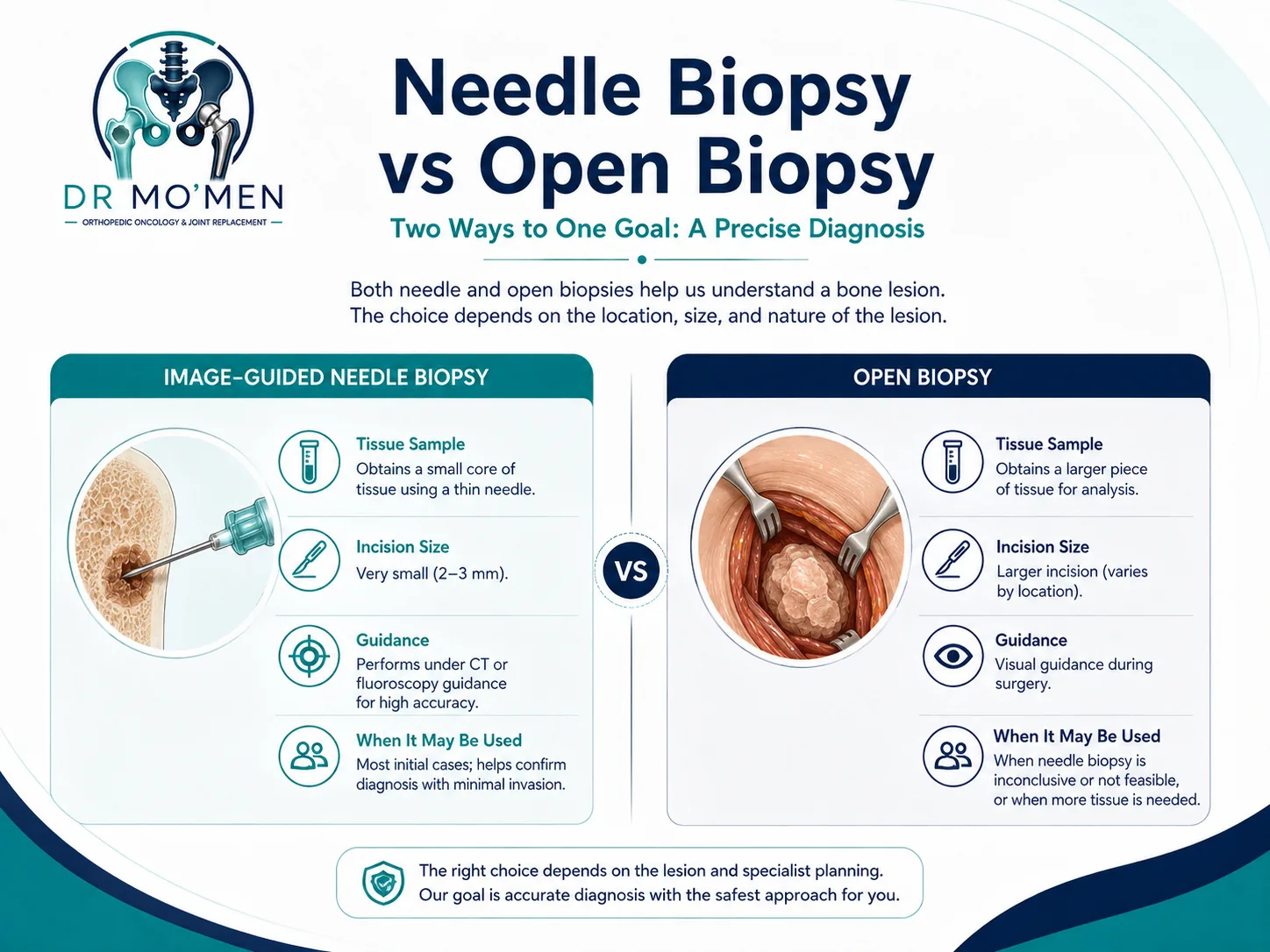 Comparison between image-guided core needle biopsy and open biopsy for a suspicious bone lesion.
