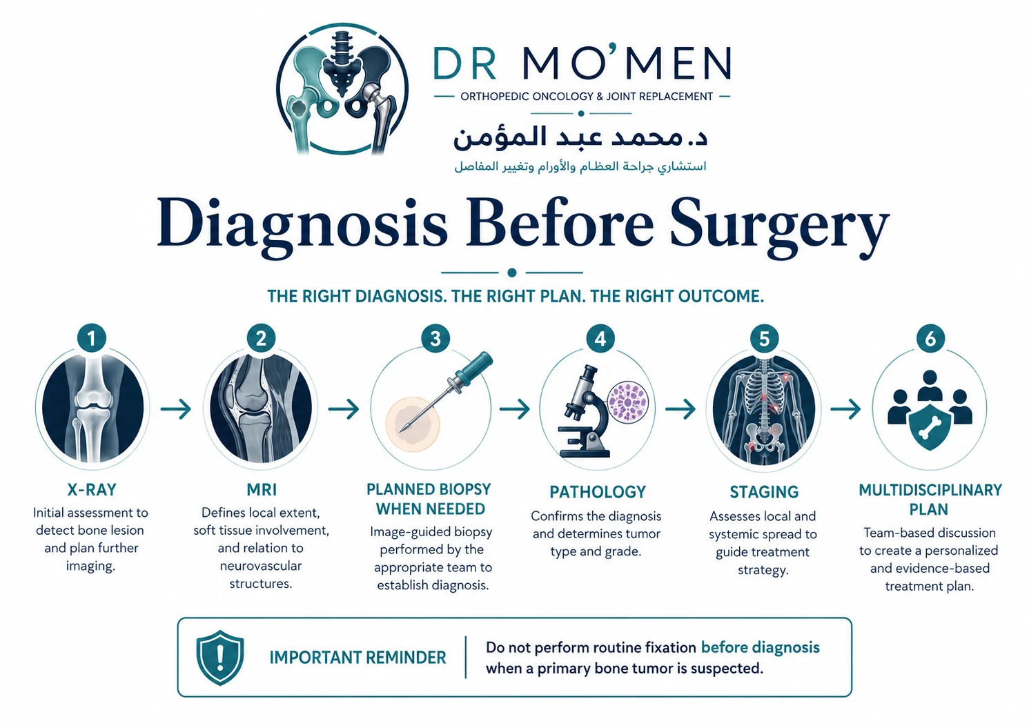 Infographic showing X-ray, MRI, planned biopsy, pathology, staging and multidisciplinary review for a bone tumor around the knee