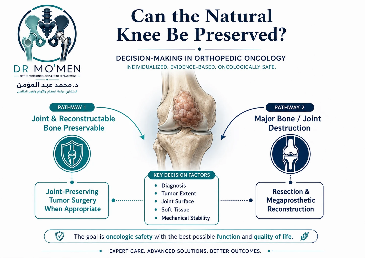 Orthopedic oncology infographic comparing joint-preserving bone tumor surgery with resection and megaprosthetic reconstruction around the knee