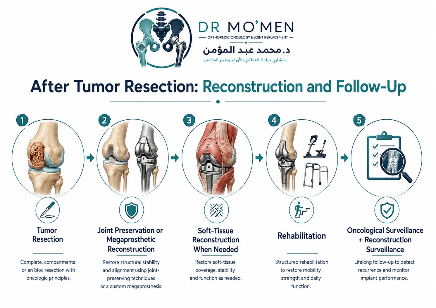 Infographic showing limb salvage, reconstruction, rehabilitation and long-term follow-up after bone tumor surgery around the knee