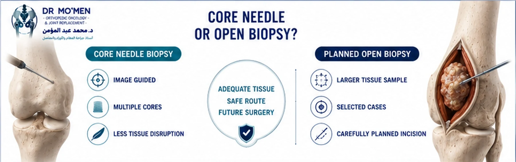 Infographic comparing core needle biopsy and planned open incisional biopsy for bone tumors.