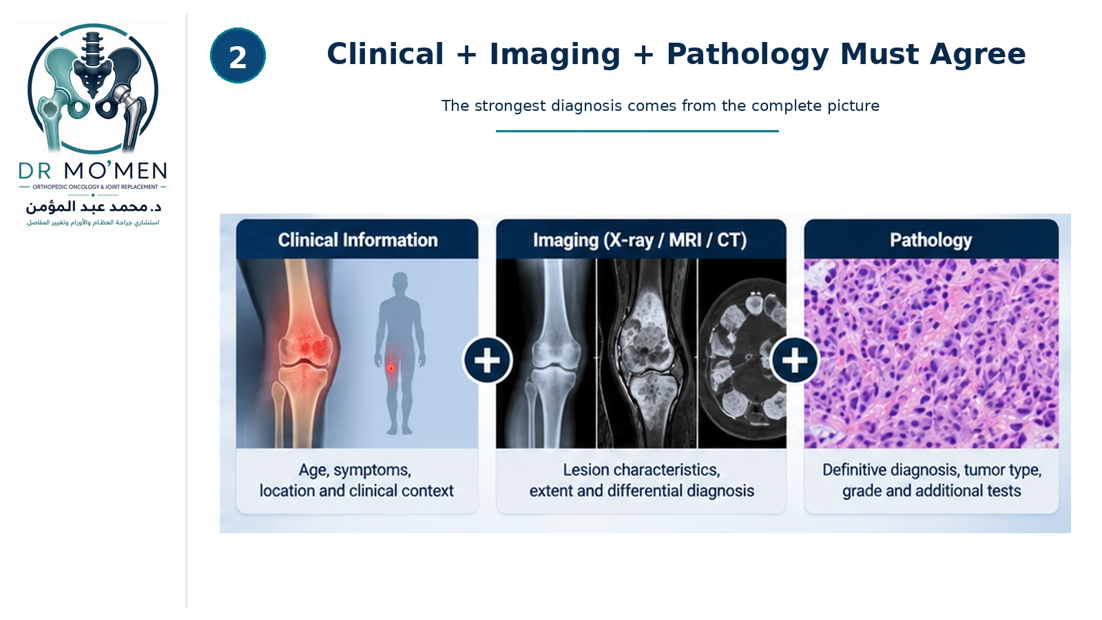 Infographic showing clinical information, imaging and pathology as the three components used together to establish a bone tumor diagnosis.
