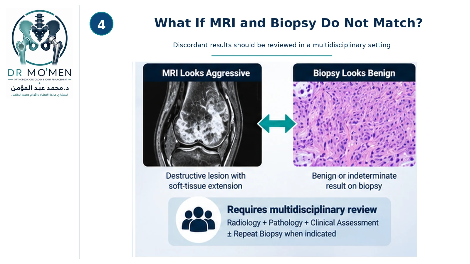 Orthopedic oncology infographic showing an aggressive-appearing MRI beside a benign or indeterminate biopsy result and the need for multidisciplinary review.