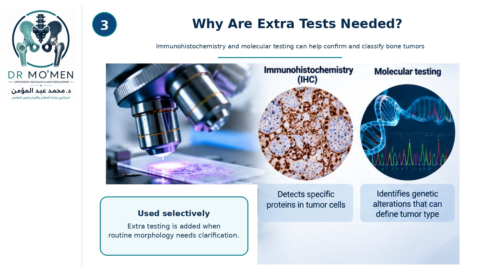 Infographic explaining how immunohistochemistry and molecular testing can help classify selected bone tumors.