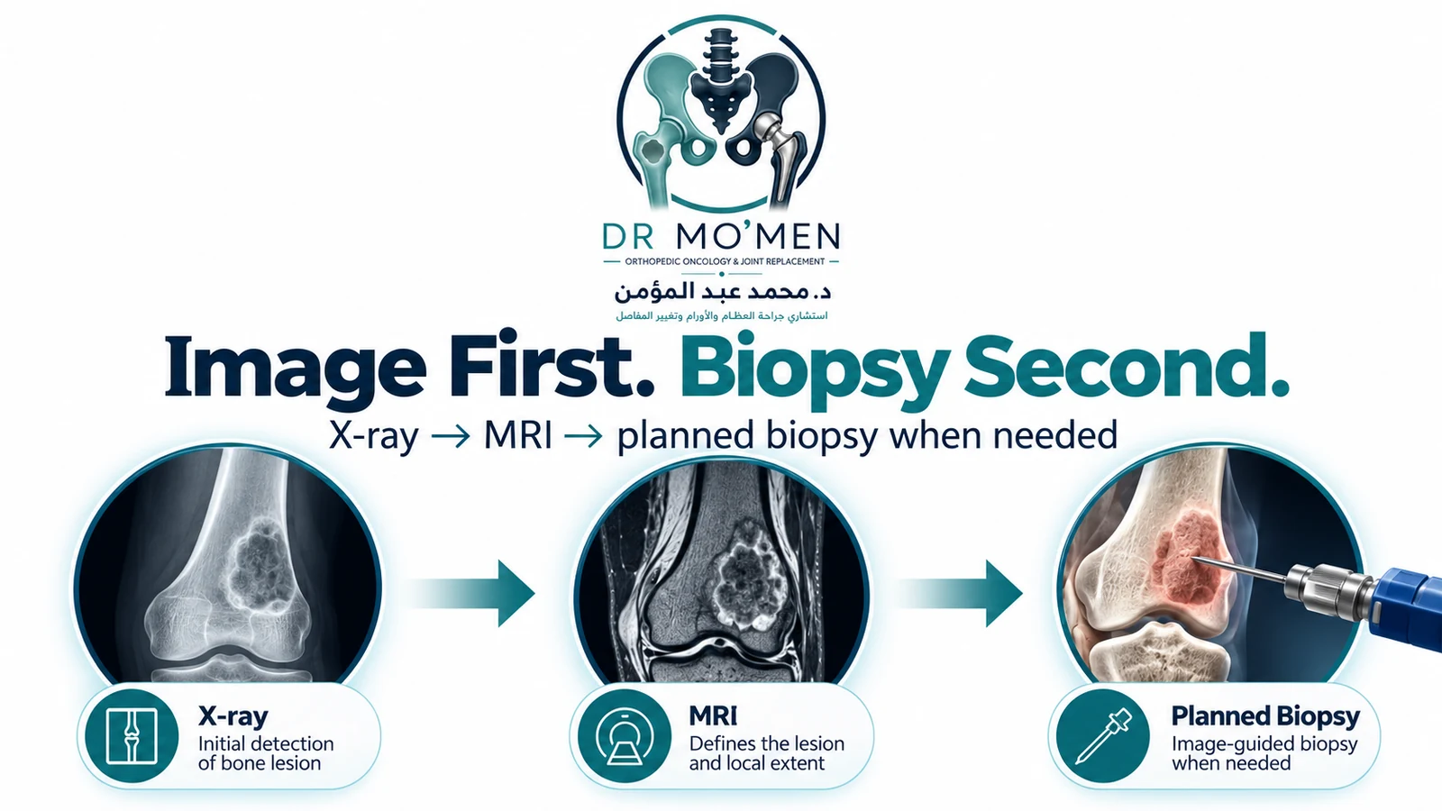 Image First. Biopsy Second. Orthopedic oncology pathway showing X-ray, MRI and planned image-guided biopsy when tissue diagnosis is needed.