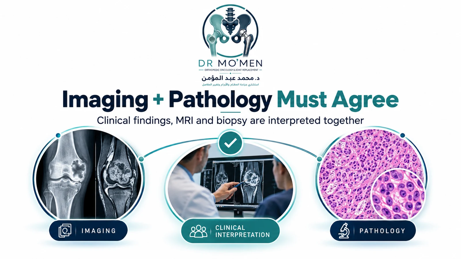 Imaging + Pathology Must Agree Infographic showing that imaging, clinical interpretation and pathology are correlated when diagnosing a bone tumor.