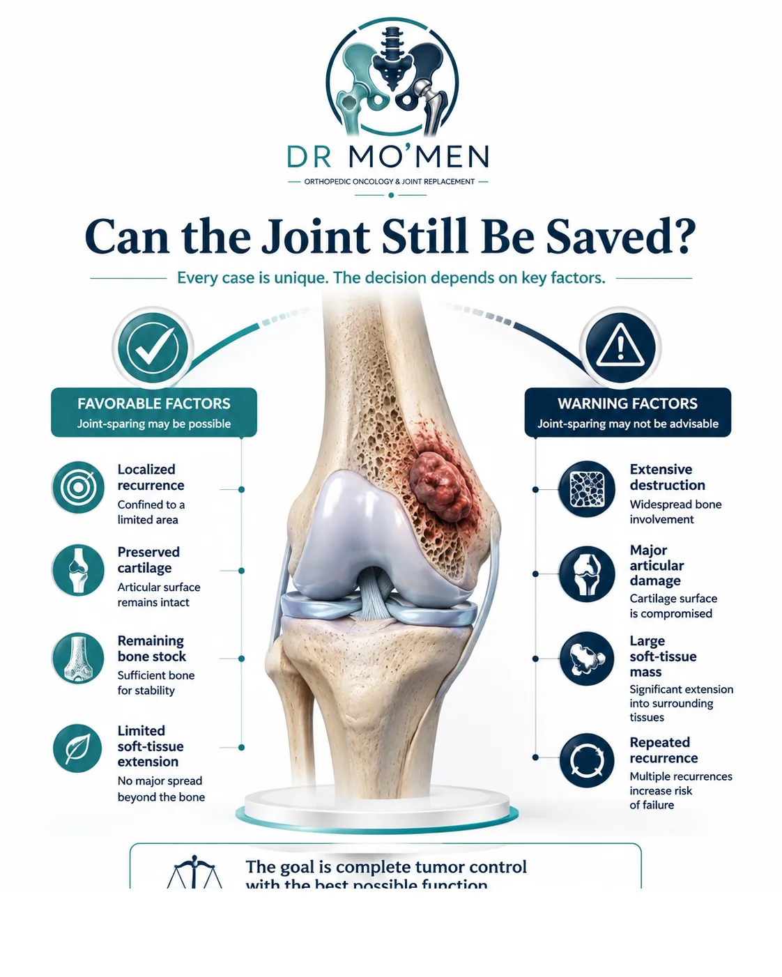 Factors used to decide whether the native joint can be preserved after recurrent bone tumor