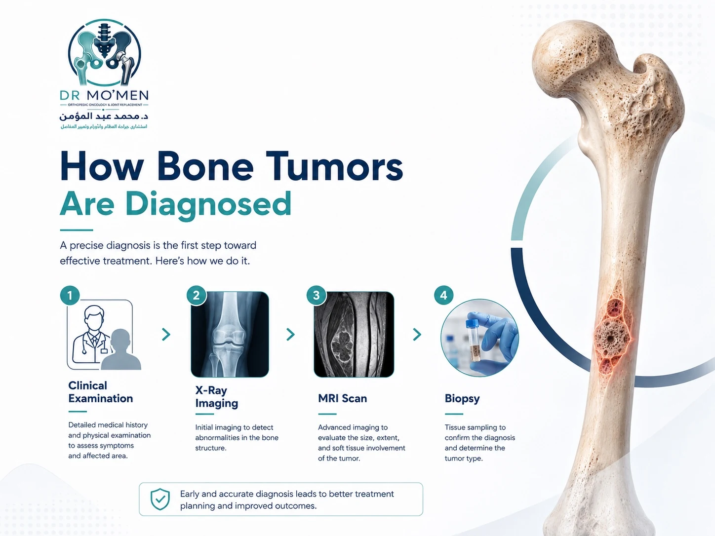 Infographic showing clinical examination, X-ray imaging, MRI scan, and biopsy in the evaluation of a bone tumor.