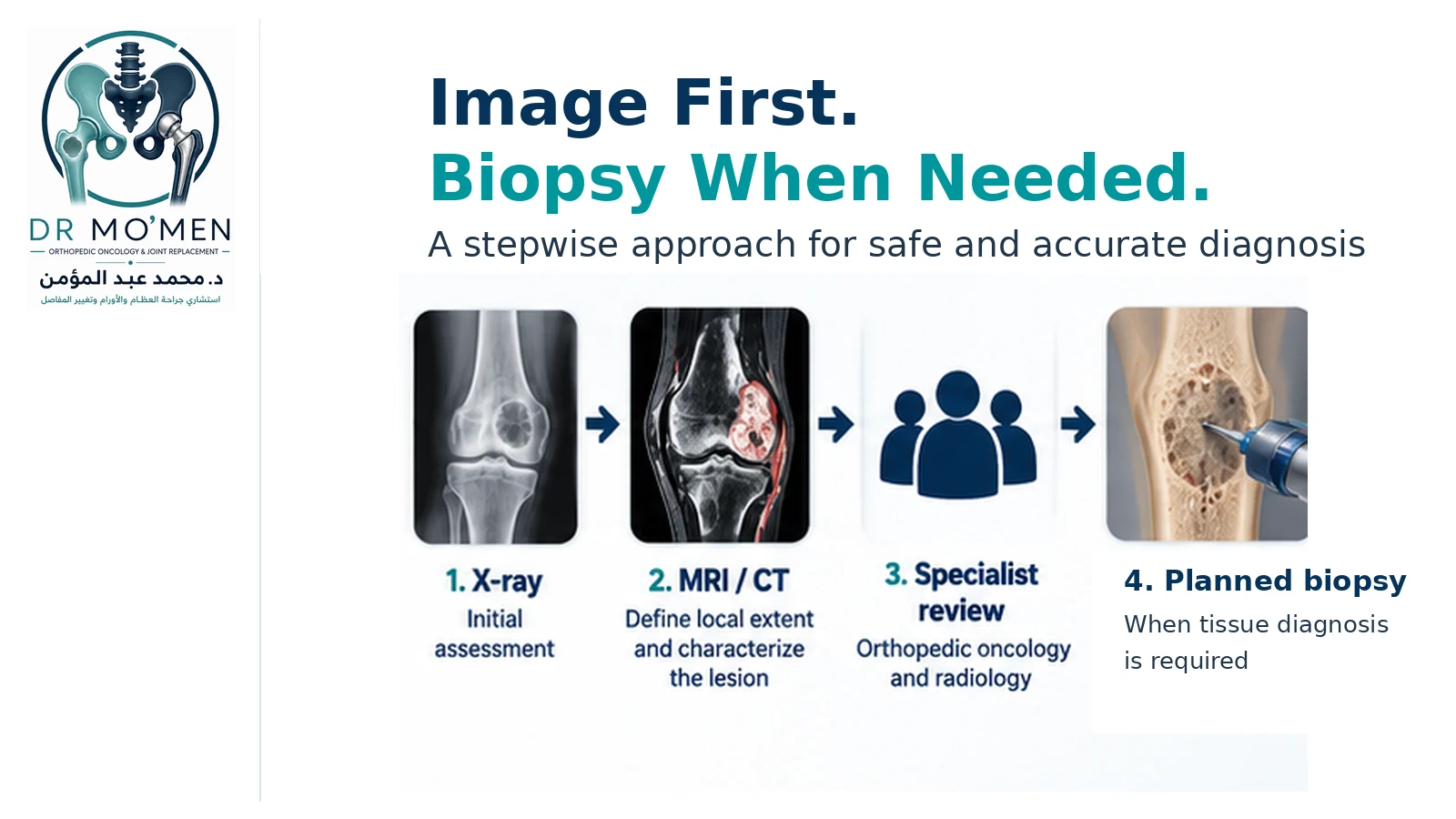 Image First. Biopsy When Needed. Stepwise orthopedic oncology pathway showing X-ray, MRI or CT, specialist review and planned biopsy when tissue diagnosis is required.