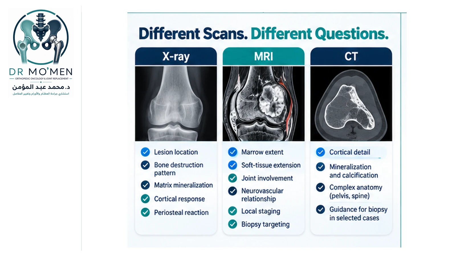 Different Scans. Different Questions. Comparison infographic showing the complementary roles of X-ray, MRI and CT in bone-tumor assessment.