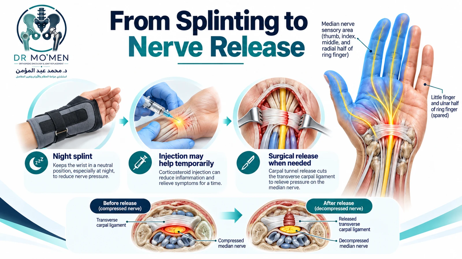 From Splinting to Carpal Tunnel Release Medical infographic showing night splinting, selective corticosteroid injection, and surgical carpal tunnel release.