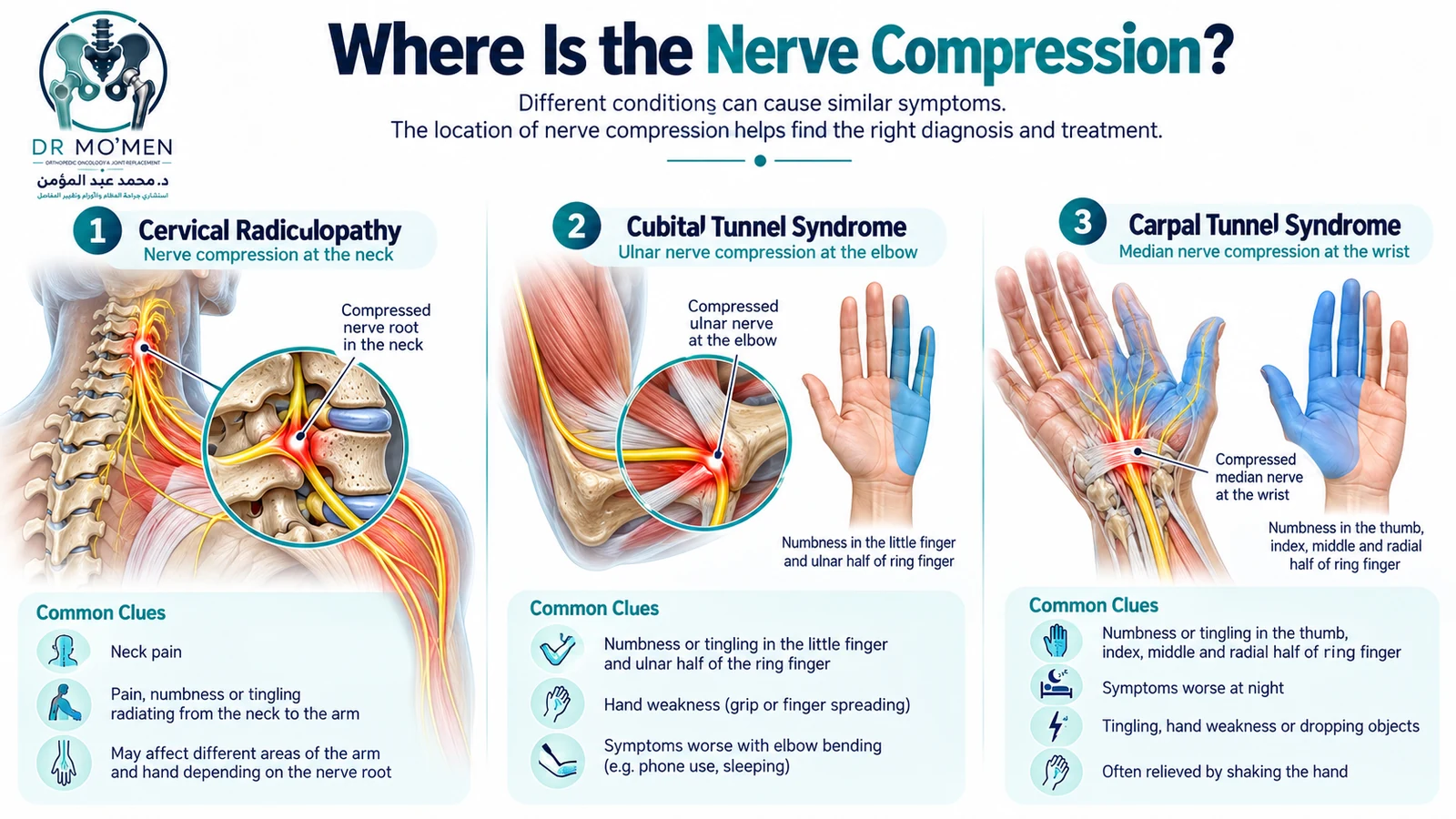 Carpal Tunnel vs Cubital Tunnel vs Cervical Radiculopathy Medical infographic comparing cervical radiculopathy, cubital tunnel syndrome, and carpal tunnel syndrome as causes of hand numbness.