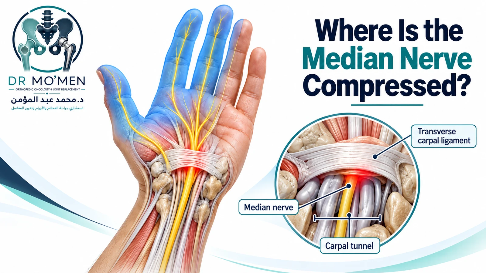 Where Is the Median Nerve Compressed? 3D medical illustration showing the median nerve beneath the transverse carpal ligament within the carpal tunnel.