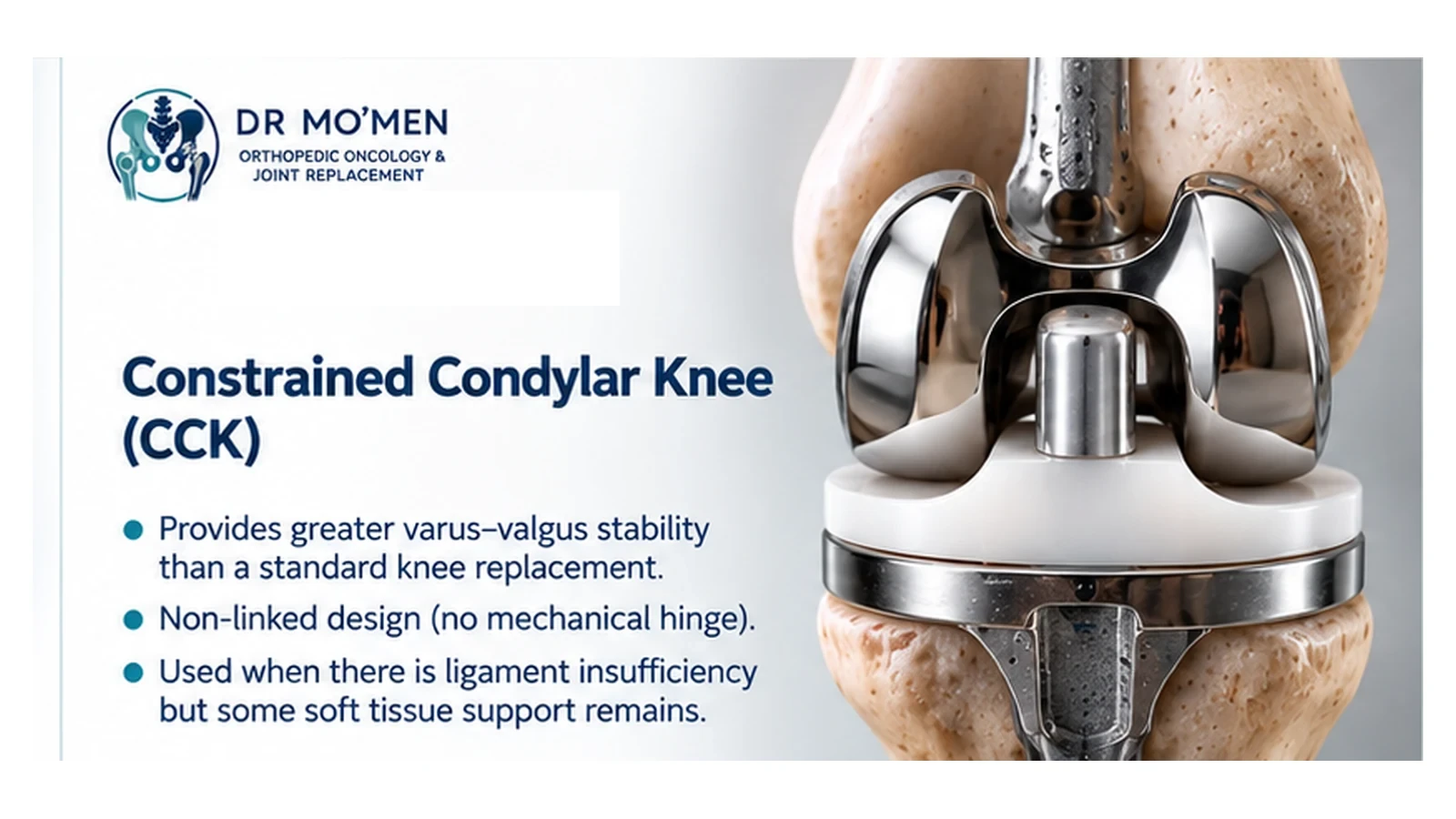 Medical illustration explaining a constrained condylar knee as a high-constraint, nonlinked knee replacement design.