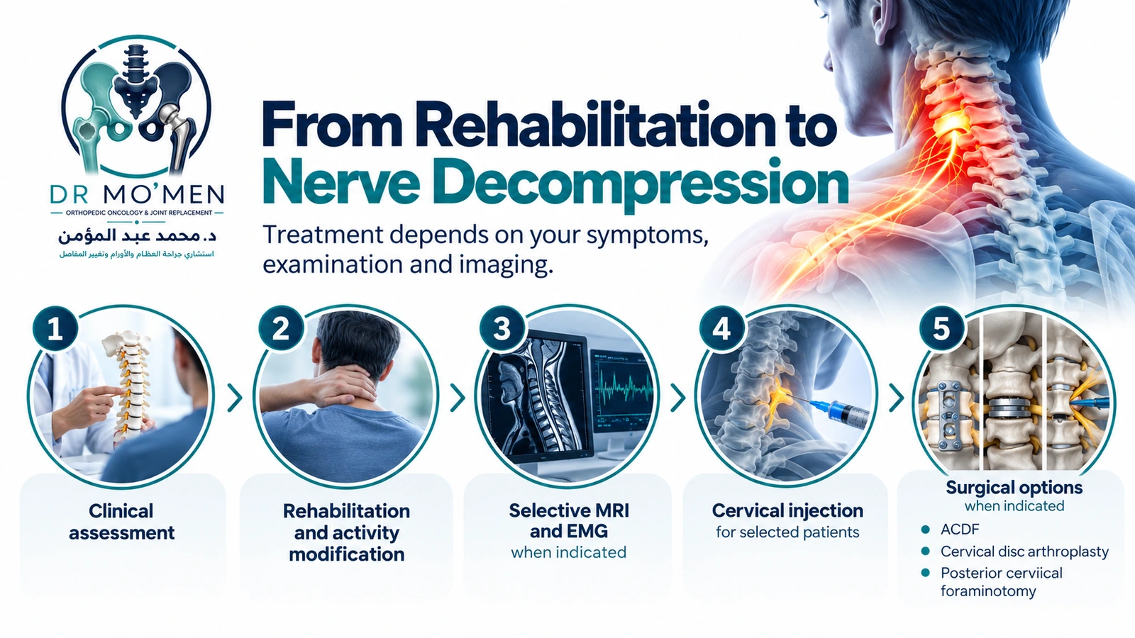 Treatment pathway for cervical radiculopathy showing clinical assessment, rehabilitation, selective MRI and EMG, selected cervical injection and surgery when indicated.