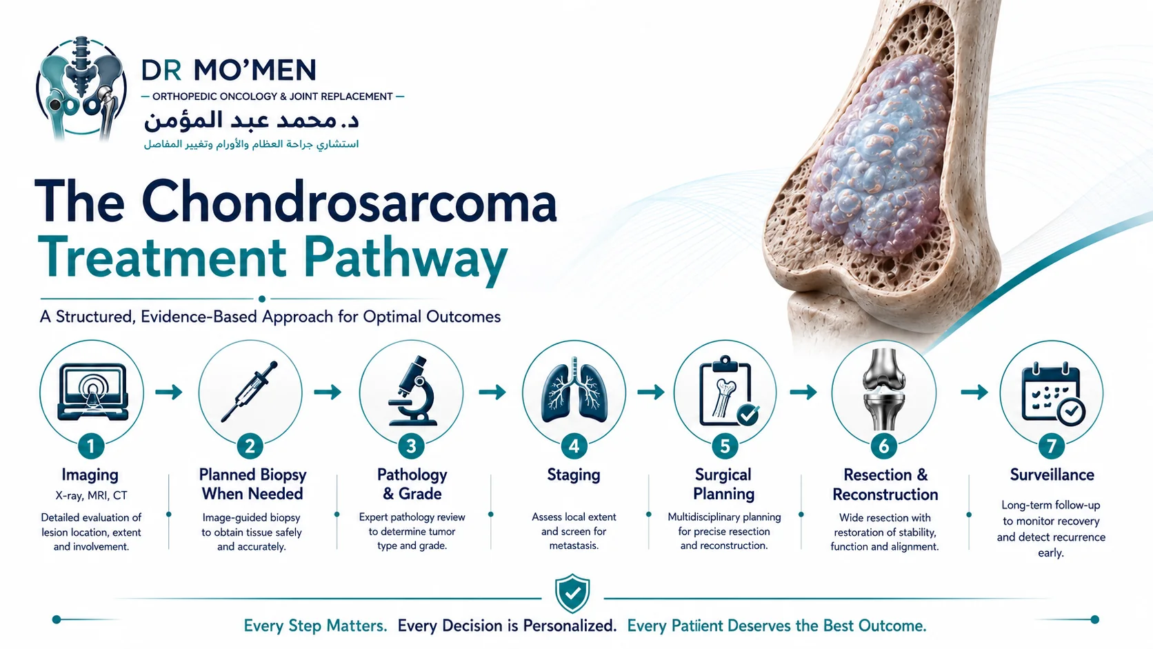 Orthopedic oncology infographic showing the pathway from imaging and biopsy to grading, staging, surgery, reconstruction and follow-up for chondrosarcoma