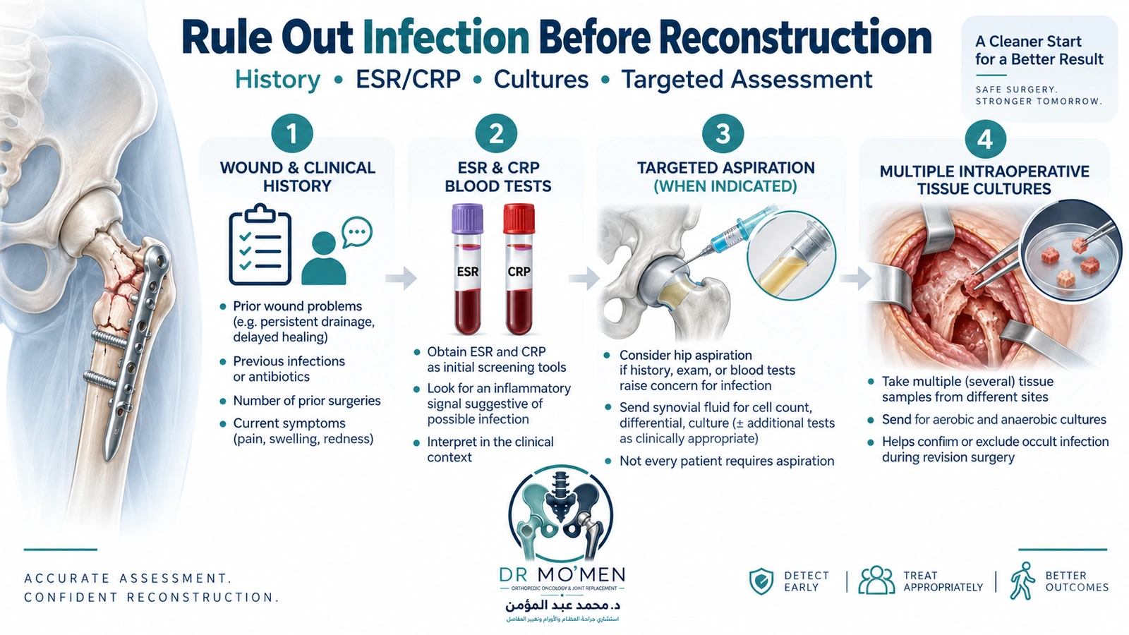 Medical infographic showing infection screening before conversion hip replacement after failed fracture fixation.