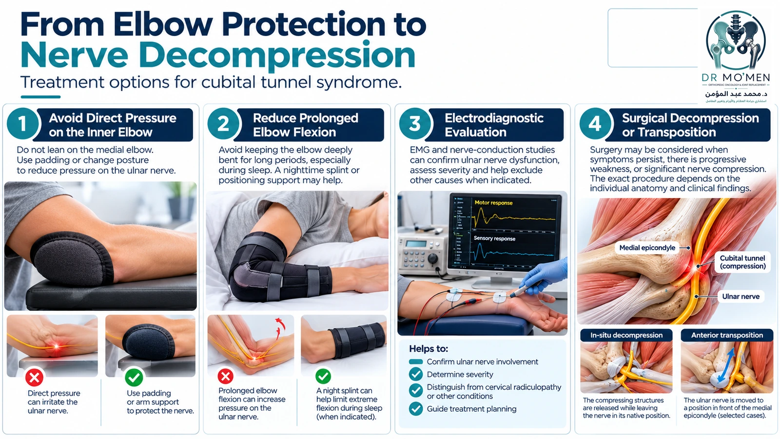 Infographic showing elbow protection, reduced flexion, selective electrodiagnostic testing and surgery when indicated for cubital tunnel syndrome.