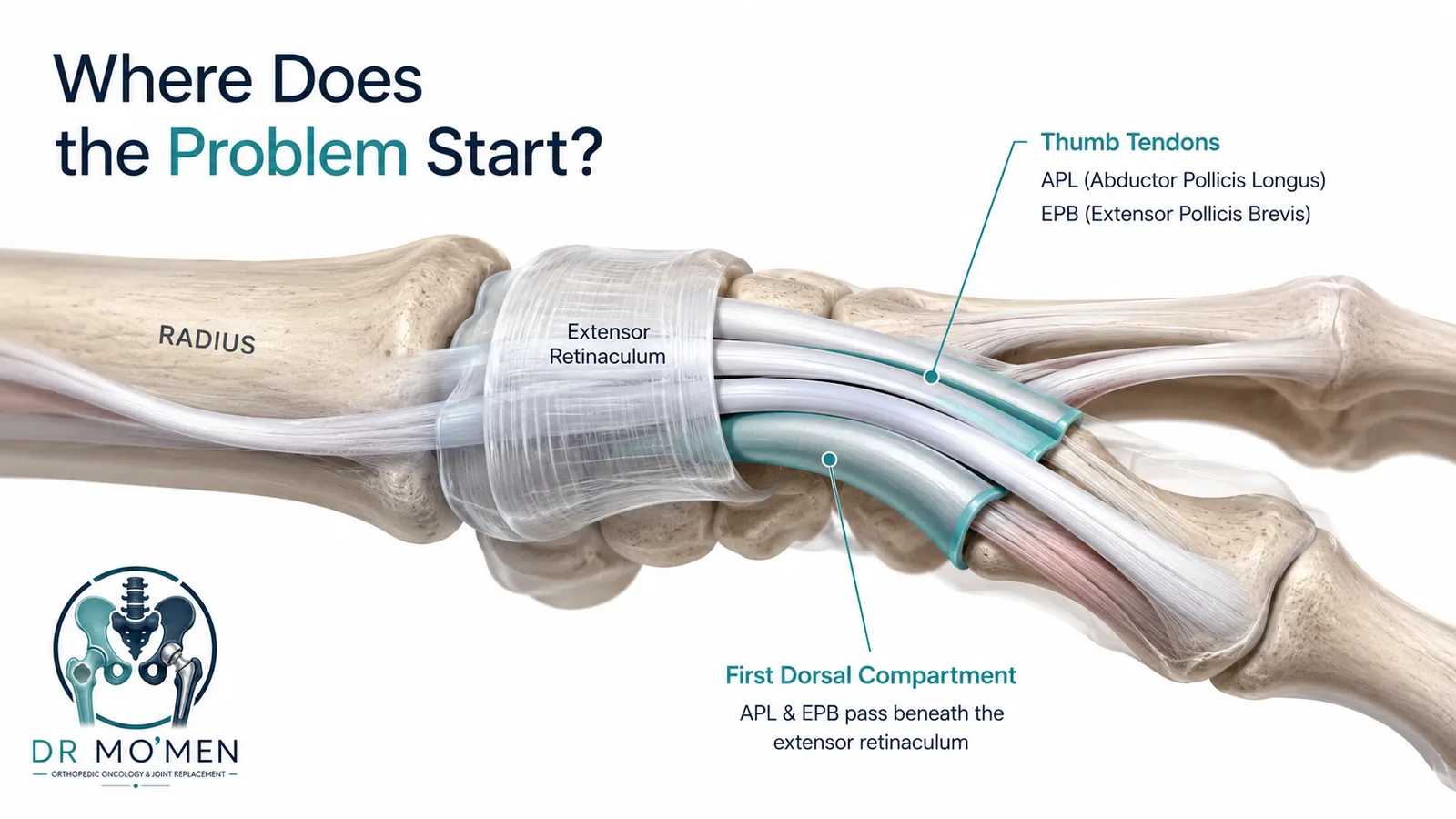 Medical anatomy illustration showing the APL and EPB thumb tendons passing through the first dorsal compartment.