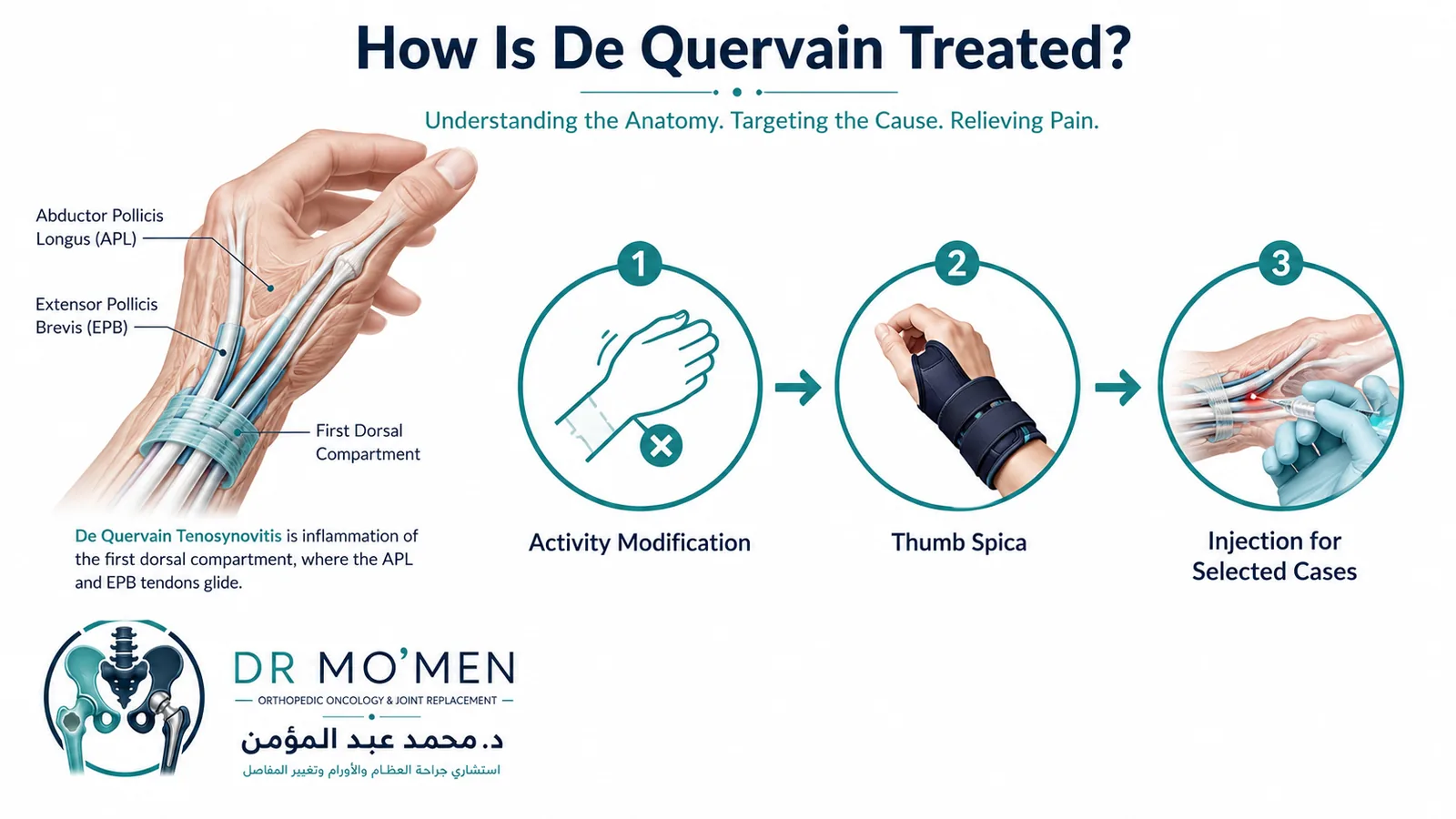 Treatment infographic showing activity modification, thumb-spica splinting, and injection for selected cases.