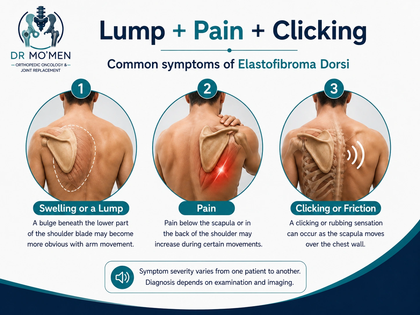 Infographic showing swelling, pain, and clicking or friction associated with elastofibroma dorsi