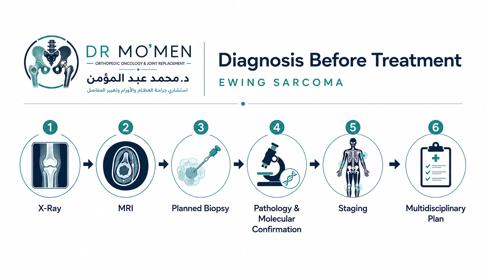 Infographic showing Ewing sarcoma diagnosis from imaging through planned biopsy, pathology, staging and multidisciplinary review