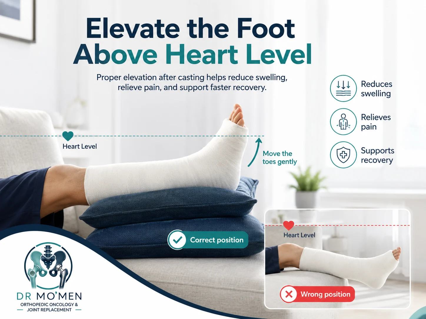 Instructional image showing correct elevation of a casted leg on pillows compared with the wrong dependent position