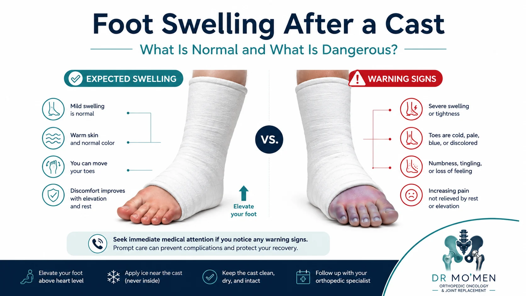 Medical infographic comparing expected mild swelling after a cast with warning signs such as blue toes, numbness, severe tightness, and increasing pain