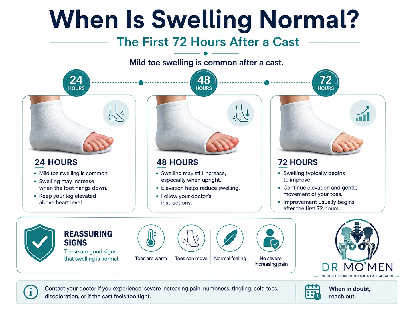 Timeline infographic describing expected swelling at 24, 48, and 72 hours after cast application and reassuring signs