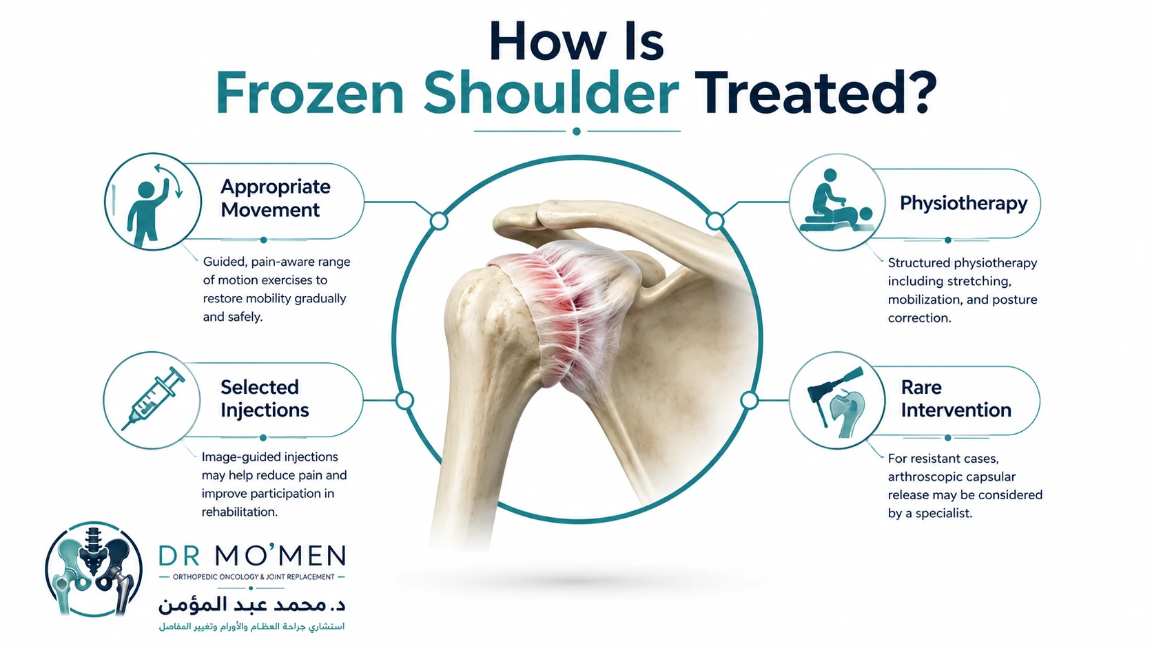 Frozen shoulder treatment infographic showing appropriate movement, physiotherapy, selected injections and rare intervention.