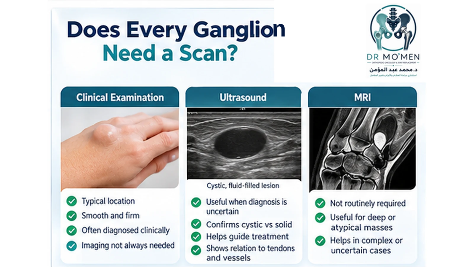 Infographic explaining clinical diagnosis, ultrasound and MRI use for a suspected wrist ganglion cyst.