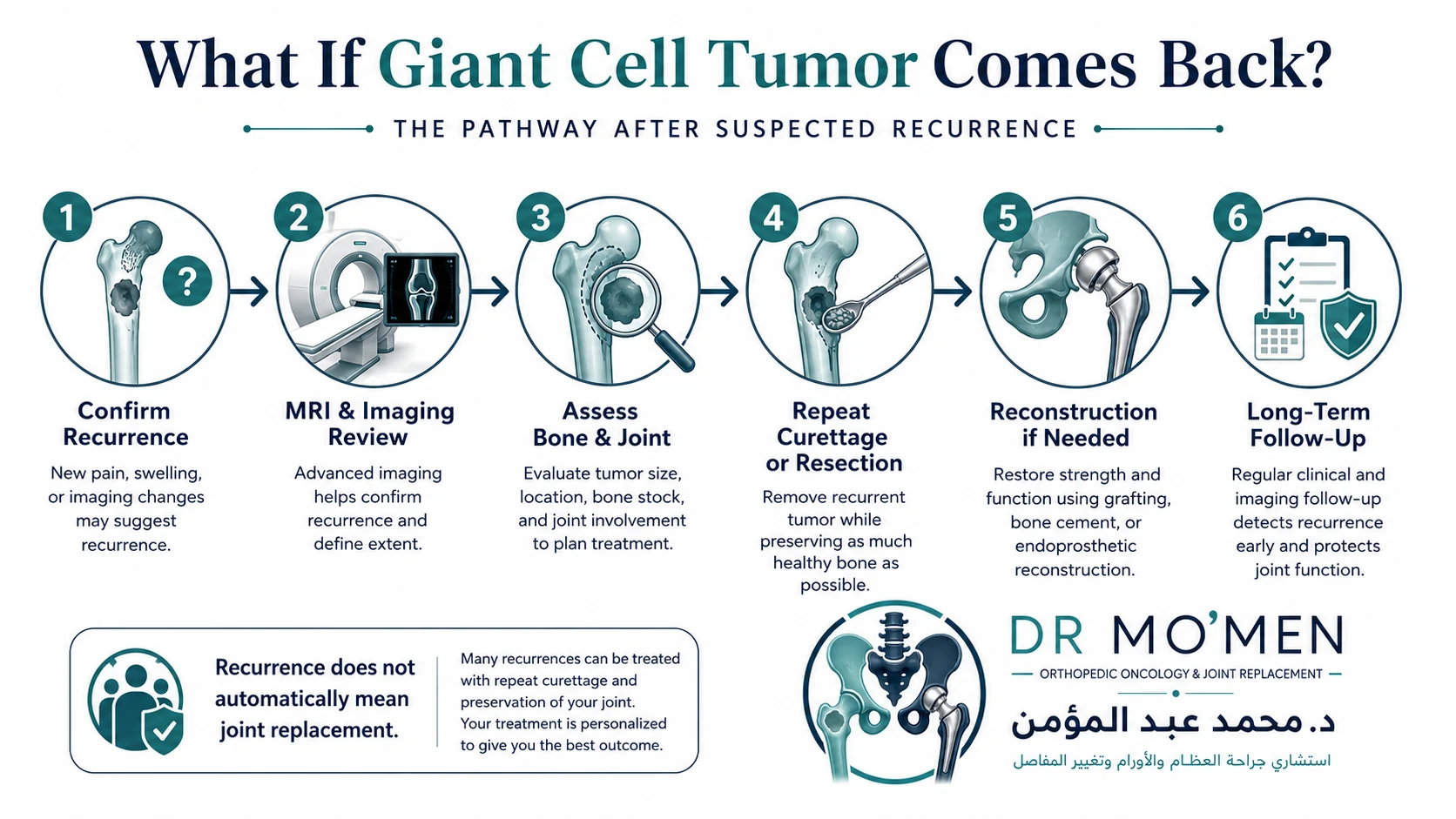 Infographic showing reassessment and treatment options when giant cell tumor of bone recurs