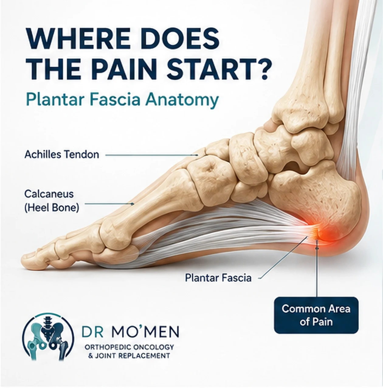 Anatomy of the plantar fascia, calcaneus and Achilles tendon