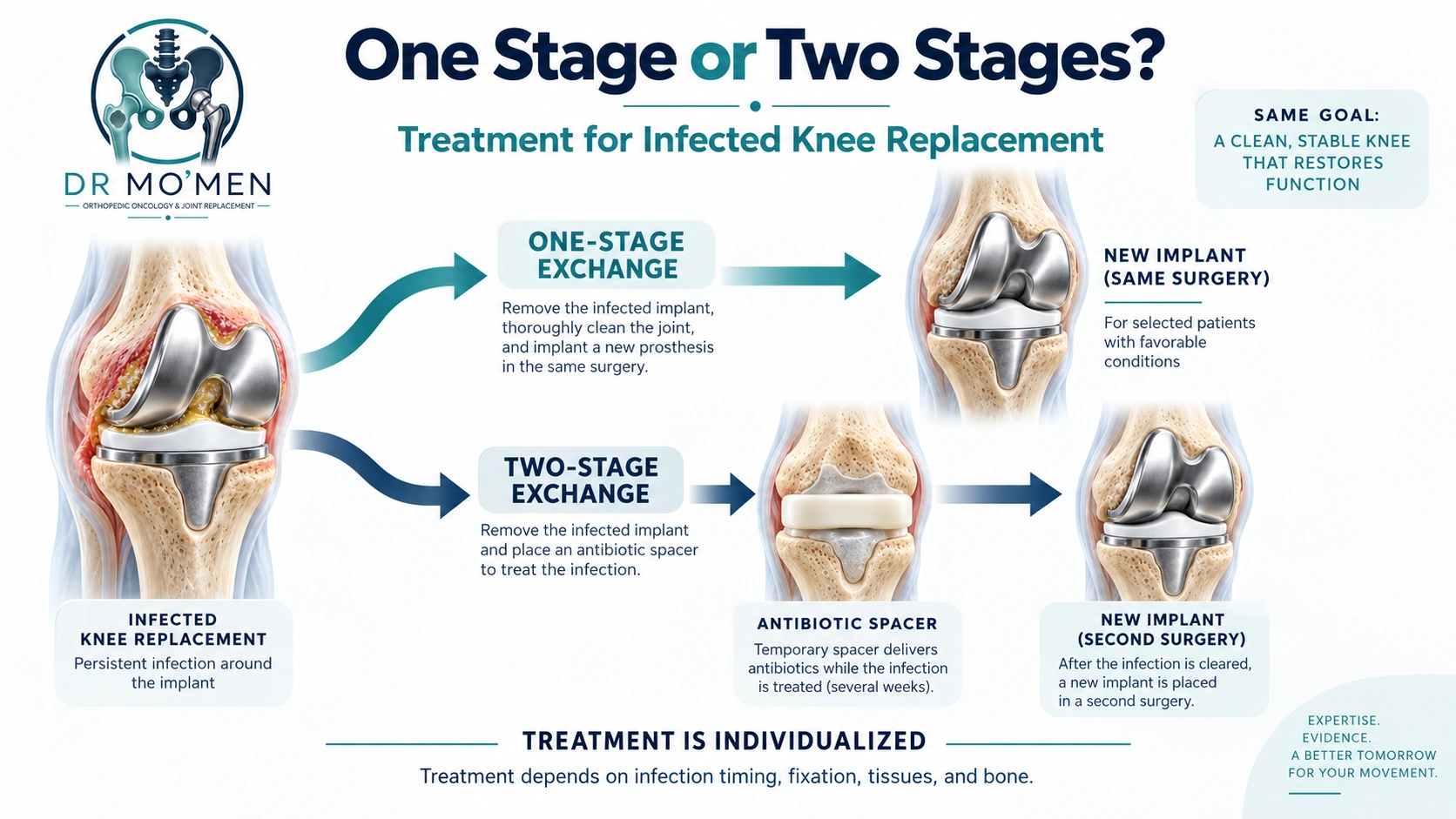 One stage or two stages?