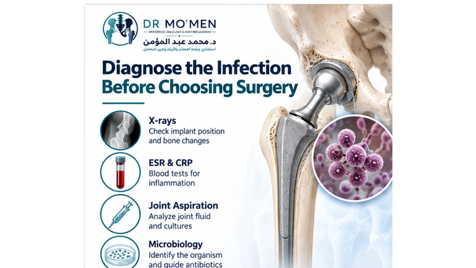 Diagnose the Infection Before Choosing Surgery Infographic showing X-rays, ESR and CRP testing, joint aspiration and cultures in the diagnosis of hip prosthetic joint infection.