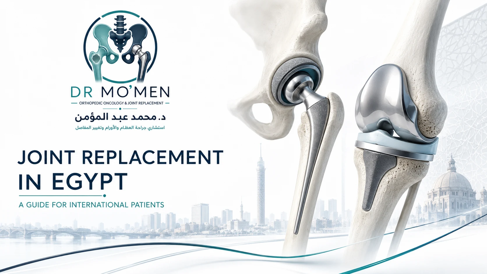 3D hip and knee replacement implants representing joint replacement treatment for international patients in Egypt