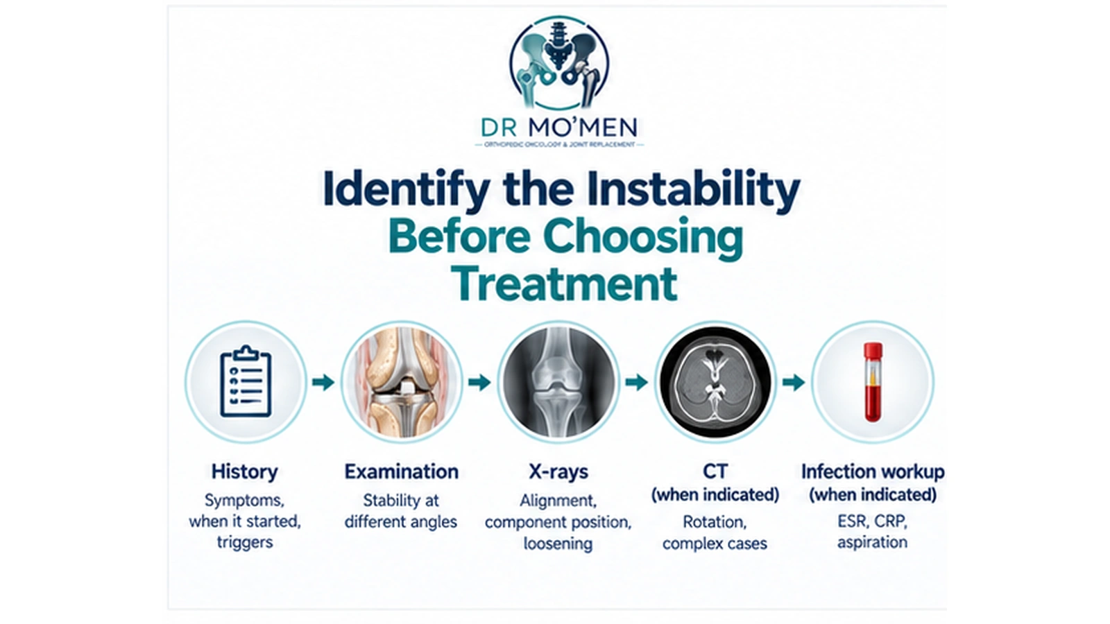 Identify the Instability Before Choosing Treatment Infographic showing the diagnostic workup for instability after total knee replacement.