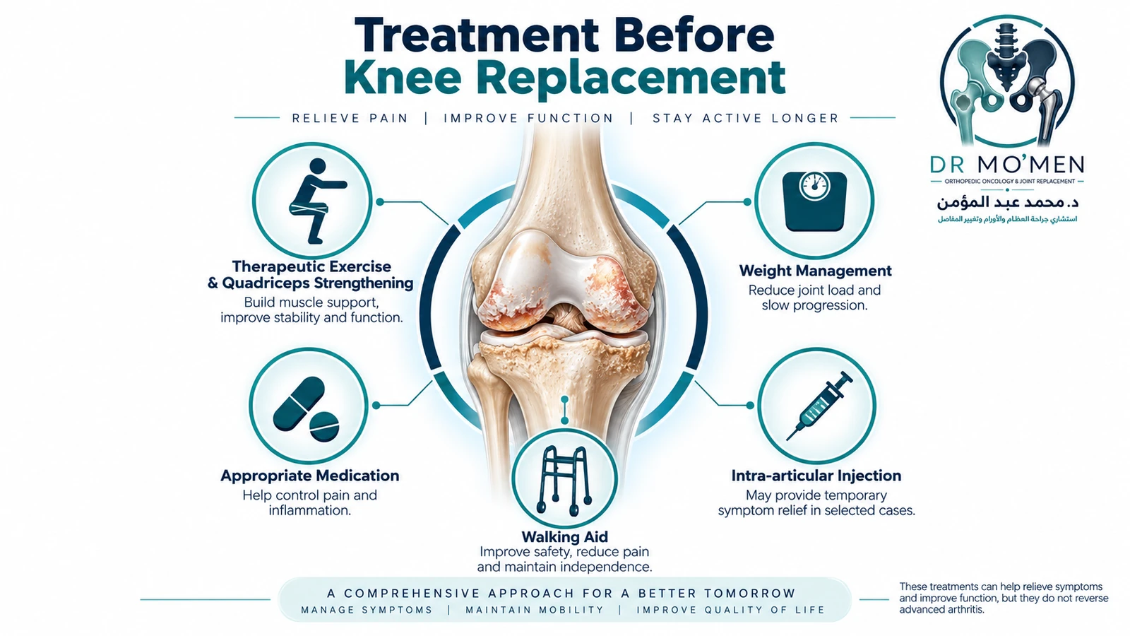 Treatment Before Knee Replacement Medical illustration showing exercise, weight management, medication, selected injections and walking support as non-surgical treatment options for knee arthritis.