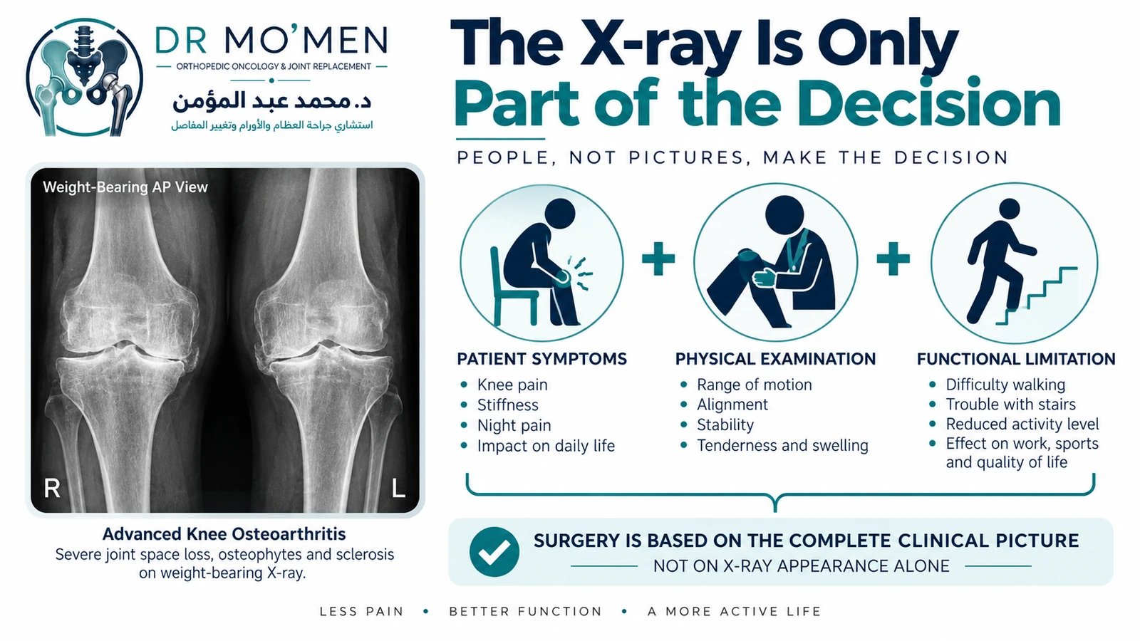 The X-ray Is Only Part of the Decision Illustration explaining that knee replacement decisions combine symptoms, clinical examination and weight-bearing X-rays rather than X-ray severity alone.